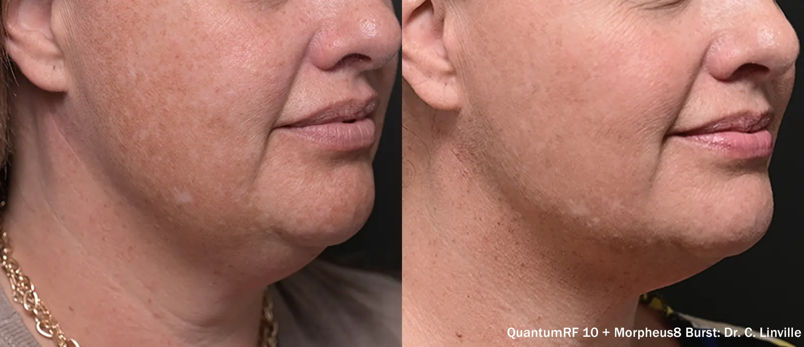 Kombinationsprotokoll — Dr C. Clifton